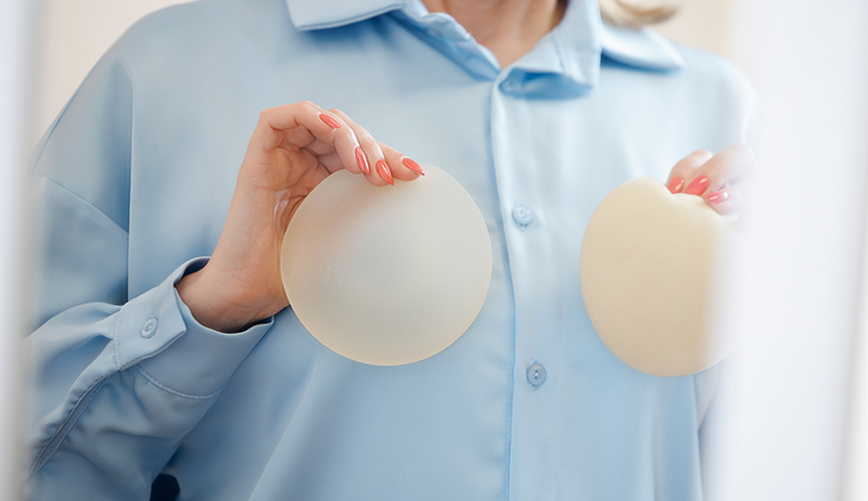A patient holding different-sized implants in a breast augmentation consultation.